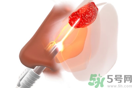 鼻咽癌的日常措施是什么？鼻咽癌注意的飲食有哪些？