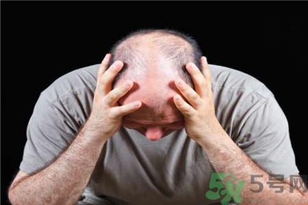 脫發(fā)的高發(fā)人群有哪些？如何預(yù)防脫發(fā)？