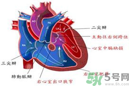 先天性心臟病發(fā)病原因是什么？