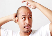 脫發(fā)的高發(fā)人群有哪些？如何預(yù)防脫發(fā)？