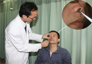鼻咽癌的發(fā)病因素是什么？鼻咽癌的并發(fā)癥有哪些？