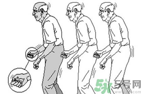 帕金森要注意哪些措施？帕金森的飲食需注意什么？