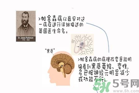 帕金森的治療方法有哪些？