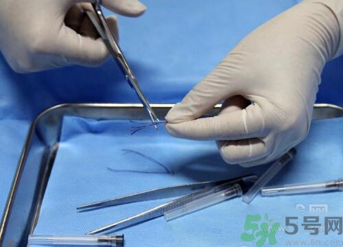 埋線減肥多少錢(qián)一次？埋線減肥的副作用