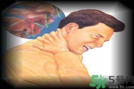 為什么年輕人容易得頸椎病？頸椎病嚴(yán)重的癥狀有哪些？