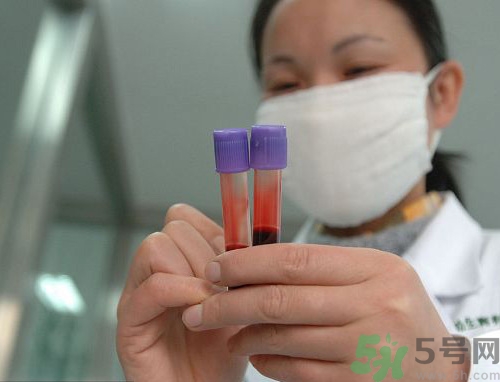 親子鑒定結(jié)果多長時(shí)間能出來?親子鑒定結(jié)果怎么看