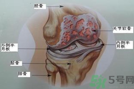 預(yù)防骨病需要注意哪些姿勢？秋季預(yù)防骨病的方法有哪些？