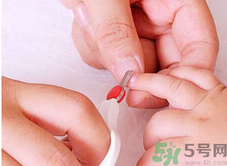 寶寶長(zhǎng)蘚是怎么回事？寶寶長(zhǎng)蘚怎么辦？