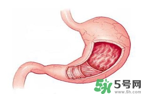 急性腸胃炎哪些食物不可以吃？急性腸胃炎不能吃的水果有？