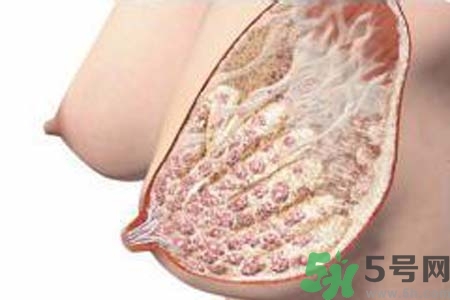乳腺增生治療方法是什么？乳腺增生的檢查方法有哪些？