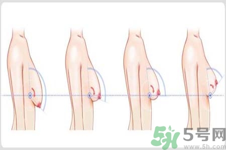 如何預(yù)防胸部松弛？吃什么能使胸部挺拔？