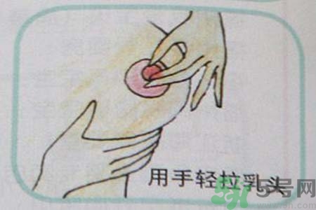 乳頭內(nèi)陷怎么回事？乳頭內(nèi)陷的原因是什么？