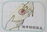 乳頭內(nèi)陷怎么回事？乳頭內(nèi)陷的原因是什么？