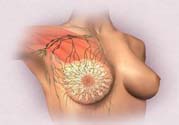 乳頭發(fā)黑是怎么回事？乳頭發(fā)黑是什么原因？