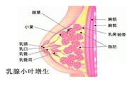 乳腺增生治療方法是什么？乳腺增生的檢查方法有哪些？