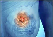 乳房有硬塊正常嗎？乳房有腫塊怎么回事？