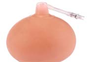 乳頭內(nèi)陷可以拔罐嗎？乳頭內(nèi)陷需要手術(shù)治療嗎？