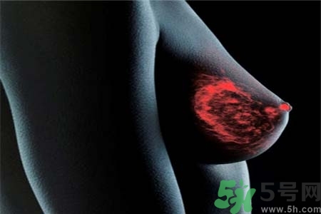 乳房上有硬塊怎么辦？乳房有硬塊的病因是什么？