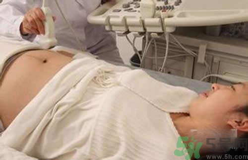 孕婦做b超要空腹嗎？孕婦做b超要不要空腹？