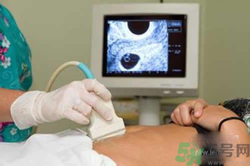 孕婦做b超要空腹嗎？孕婦做b超要不要空腹？