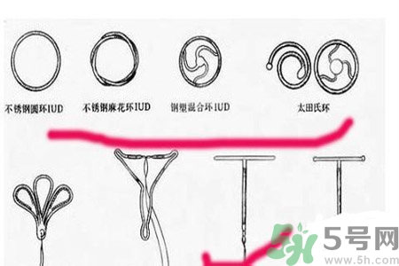 什么是宮內(nèi)節(jié)育器？放置宮內(nèi)節(jié)育器為什么能避孕？