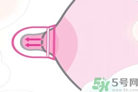 乳頭內(nèi)陷能不能喂奶？乳頭凹陷怎樣哺乳？