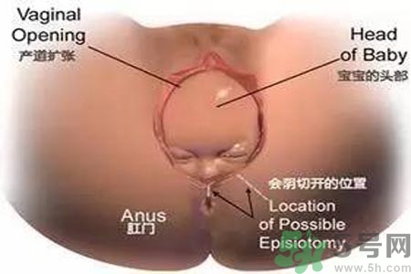 女性陰道松弛的原因是什么？女性陰道松弛怎么辦？