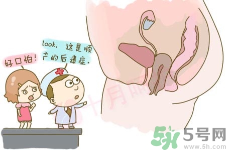 陰道松弛是什么？陰道松弛的癥狀有哪些？
