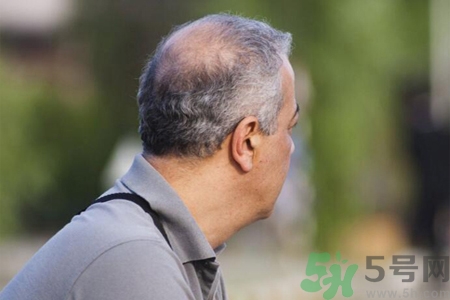 男性更年期的表現(xiàn)有哪些？怎么判斷男性更年期？