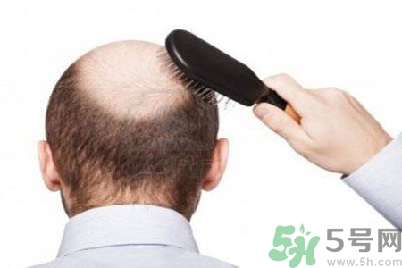 結(jié)構(gòu)性中年危機是什么？男性一生的10個年齡坎