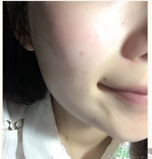 麗得姿面膜適合孕婦可以用嗎？麗得姿面膜哪些孕婦可以用？