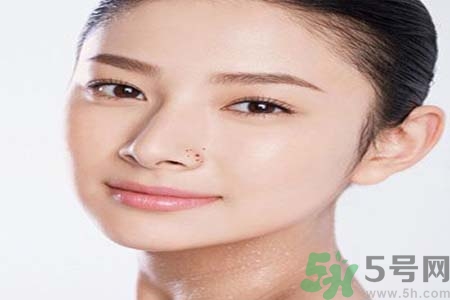 太陽(yáng)穴長(zhǎng)痘怎么辦？如何祛除太陽(yáng)穴上的痘痘？