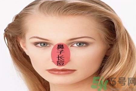 鼻翼長痘痘怎么辦？鼻翼長痘解決方法有哪些？
