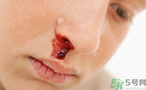 15歲男孩可以刮胡子嗎？15歲男孩經(jīng)常流鼻血怎么回事？