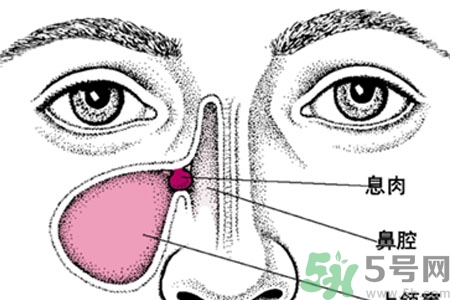 鼻子出血怎么辦？鼻子出血的原因是什么？