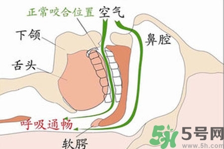 鼻子紅是什么原因？鼻子紅怎么辦？