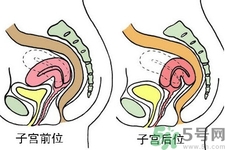 子宮移位的原因是什么？子宮移位的癥狀有哪些？