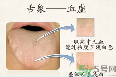 血虛怎么調(diào)理？女人血虛怎么調(diào)理？