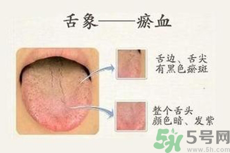 血瘀體質(zhì)吃什么？血瘀體質(zhì)怎么調(diào)理？