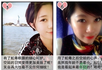 蛇毒眼膜孕婦可以用嗎？ 日本spa蛇毒眼膜孕婦能用嗎？