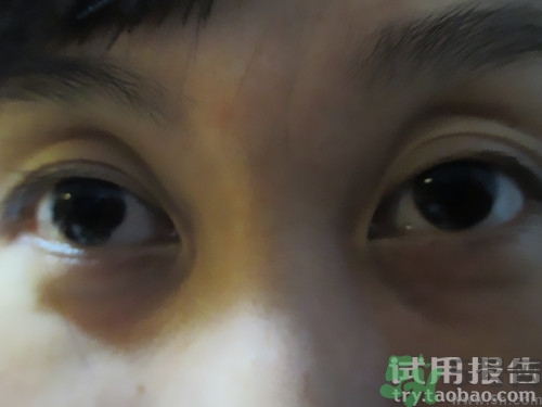 蛇毒眼膜效果怎么樣？spa蛇毒眼膜紅色好用嗎？