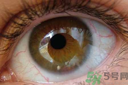 ?干眼癥的治療方法是什么？如何預(yù)防干眼癥？