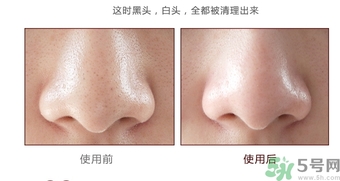 yu.r巧克力棒鼻貼怎么樣？yu.r巧克力鼻貼好用嗎？