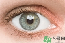 黑眼圈是怎么形成的？黑眼圈是什么原因引起的？