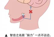 長(zhǎng)智齒疼痛怎么辦？長(zhǎng)智齒牙齦腫了怎么辦？