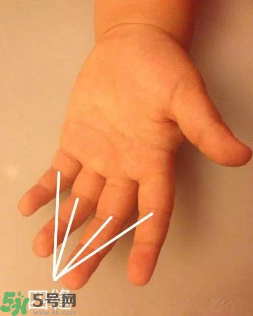 積食發(fā)燒怎么推拿？積食發(fā)燒推拿手法圖解
