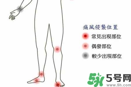 引發(fā)痛風的原因是什么？痛風病人飲食需注意什么好？