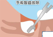 智齒拔完后有個洞怎么辦？拔智齒后有個洞多久能長好？