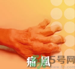 骨關(guān)節(jié)炎能治好嗎？骨關(guān)節(jié)炎平時(shí)注意事項(xiàng)