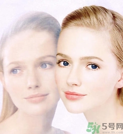 曬斑可以自己消退嗎？曬斑可以用激光去除嗎？